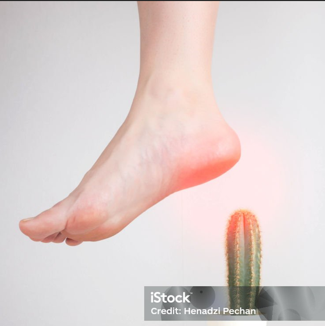 Woman experiencing severe heel pain from plantar fasciitis caused by excess weight during weight loss journey